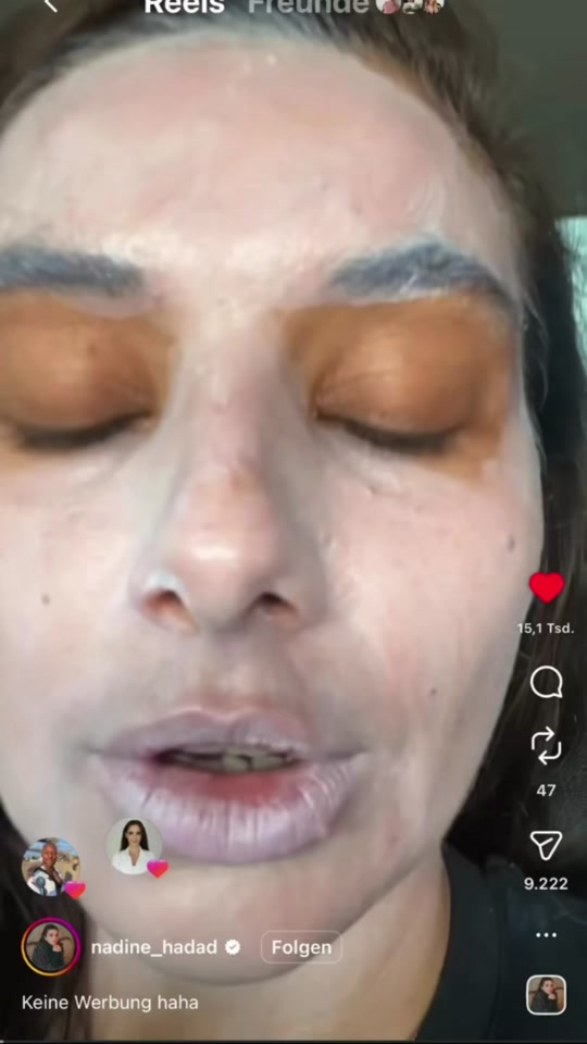 Standbild aus dem TikTok-Video von xskincare, in dem der Sonnenschutz vorkommt
